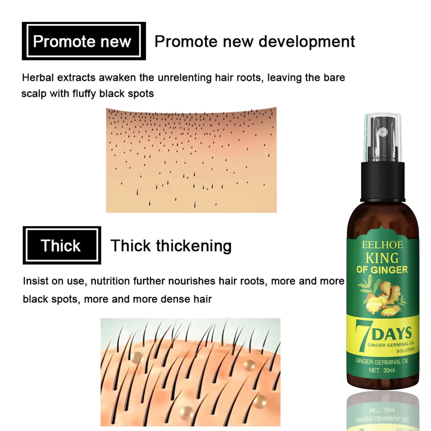 Hair Growth Serum Sprayer Hair Regrowth 30ml & 50 ml